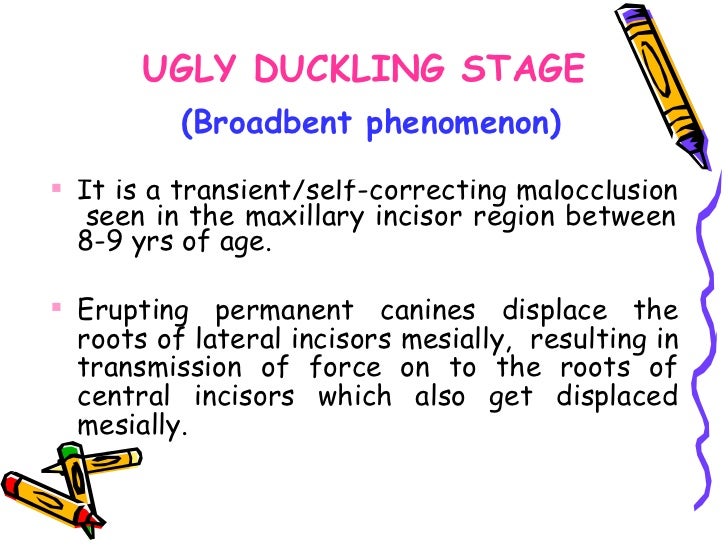 Define ugly duckling